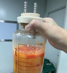 敦煌水动力吸脂手术要做多久？